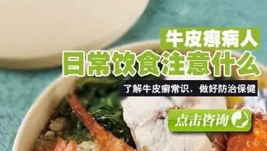 牛皮癣饮食